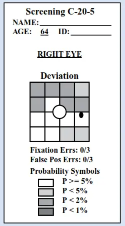 FDT-is-ideal-for-screening