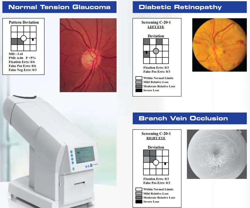 ocular-diseases-without-specialized-training