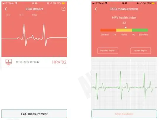 AUDAR Smart Healthcare Wristband - HRV analysis
