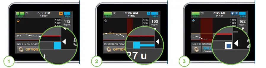 TANDEM-T-Slim-X2-Insulin-Pump-fig-1