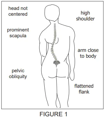 BASELINE 12-1099 Scoliosis Meter-1