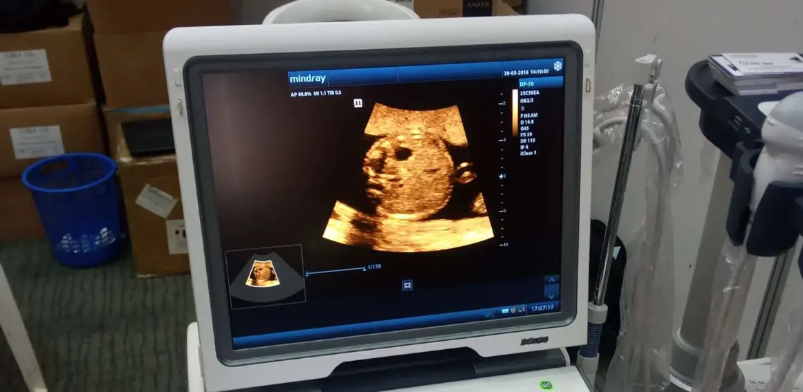 Mindray Dp-50 Expert Ultrasound Machine User Guide Mindray Dp-50 Expert Ultrasound Machine User Guide