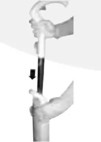 Assembling Instructions