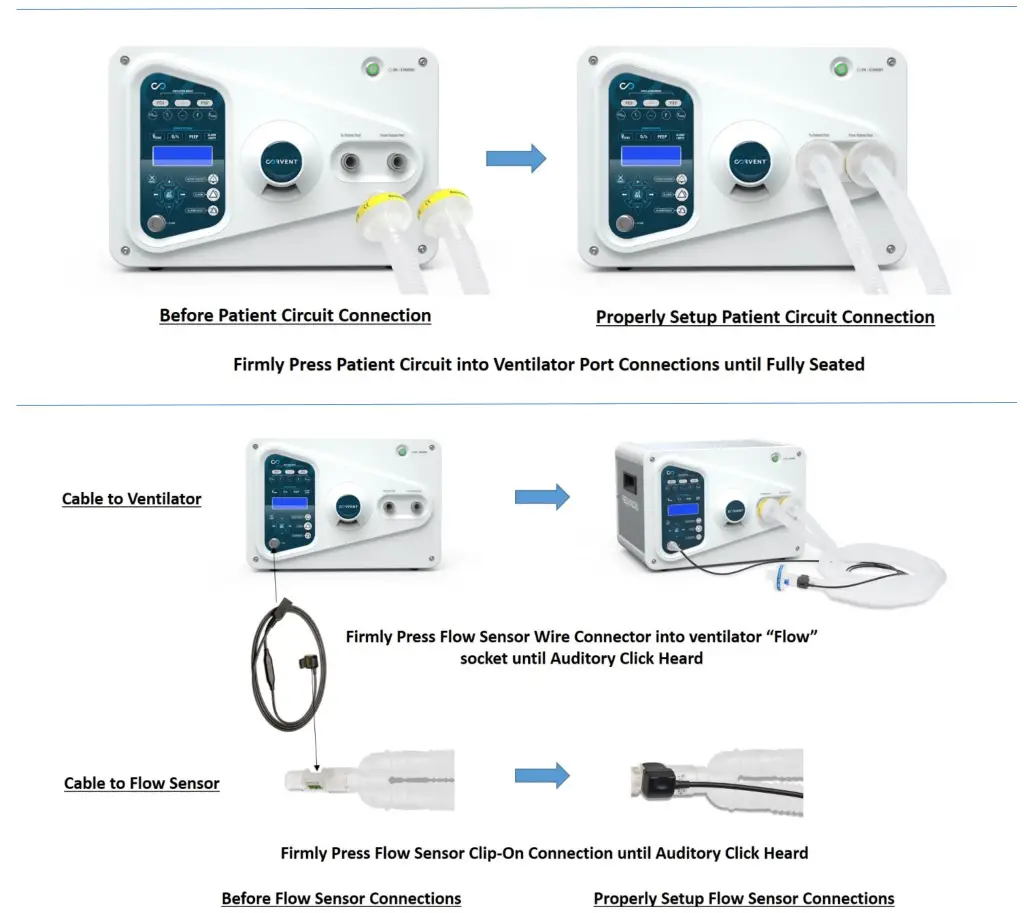 CORVENT Medical Secures CE Mark Approval For Its Critical Care Respond 19 Ventilator - Circuit Set-up