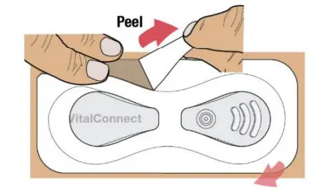 VitalConnect-VitalPatch-Adhesive-Overlay-Cardiac-Monitoring-Device-fig10