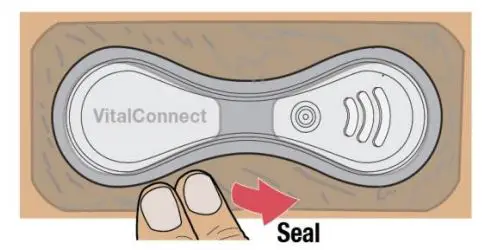 VitalConnect-VitalPatch-Adhesive-Overlay-Cardiac-Monitoring-Device-fig11