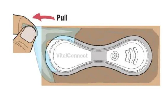 VitalConnect-VitalPatch-Adhesive-Overlay-Cardiac-Monitoring-Device-fig12