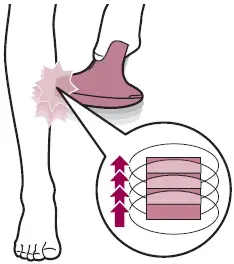 Philips-BRI921-Lumea-Advanced-Light-Hair-Remover-fig-13