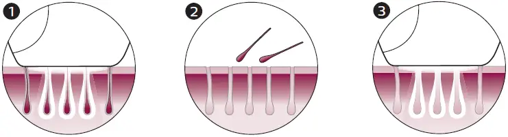 Philips-BRI921-Lumea-Advanced-Light-Hair-Remover-fig-2