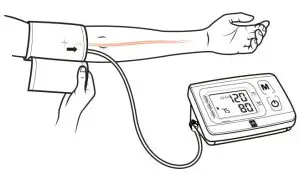 FIG 2 Cuff Placement