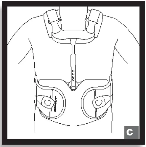 DONJOY MKTIS00-12357 IsoFORM TLSO Postural Extension 3