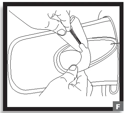 DONJOY MKTIS00-12357 IsoFORM TLSO Postural Extension 6