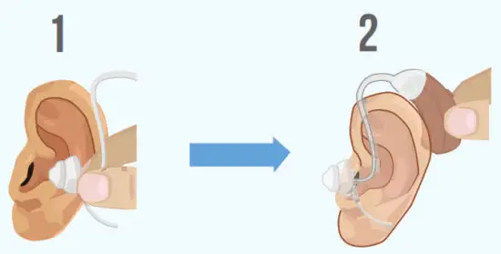 NANO RX2000 Digital Rechargeable Hearing Amplifier Set - comfortable