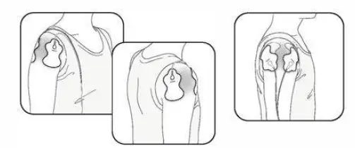 OMRON-HV-F013-Electronic-Nerve-Stimulator-10