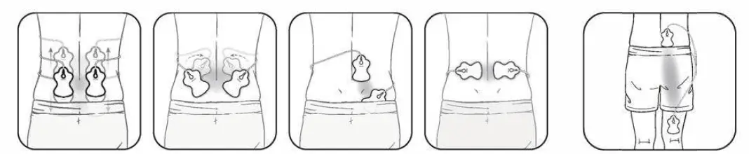 OMRON-HV-F013-Electronic-Nerve-Stimulator-11