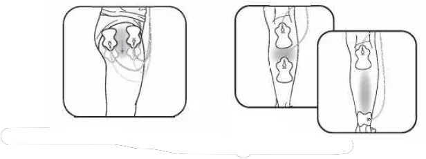 OMRON-HV-F013-Electronic-Nerve-Stimulator-12