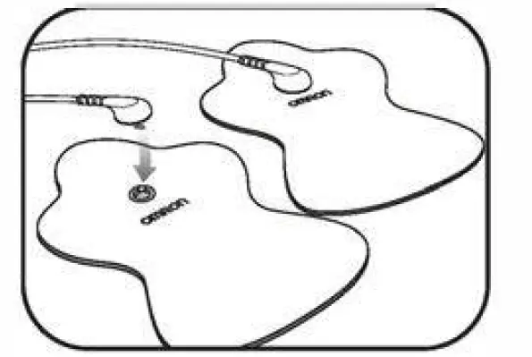 OMRON-HV-F013-Electronic-Nerve-Stimulator-6