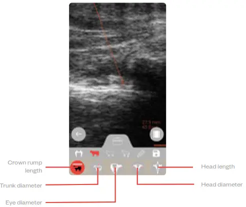 importvet 24 300 Sonda Tecnoscan BL -Cattle