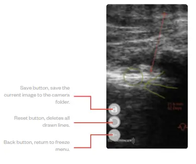 importvet 24 300 Sonda Tecnoscan BL -Freedraw
