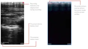importvet 24 300 Sonda Tecnoscan BL - Live scanning