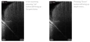 importvet 24 300 Sonda Tecnoscan BL - Scanner menu