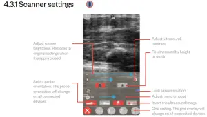importvet 24 300 Sonda Tecnoscan BL - Scanner settings