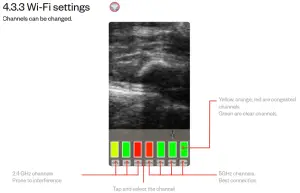 importvet 24 300 Sonda Tecnoscan BL - Wi Fi settings