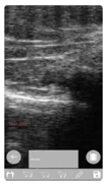 importvet 24 300 Sonda Tecnoscan BL - fig2