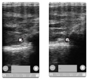 importvet 24 300 Sonda Tecnoscan BL - scanner buttons