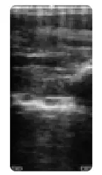 importvet 24 300 Sonda Tecnoscan BL - take up