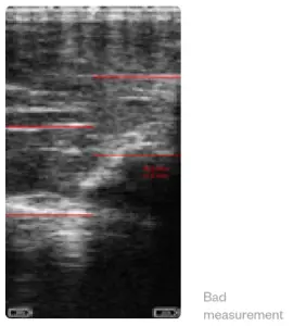 importvet 24 300 Sonda Tecnoscan BL - touch the icon 1