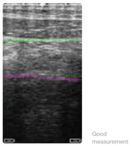 importvet 24 300 Sonda Tecnoscan BL - touch the icon