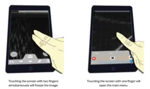 importvet 24 300 Sonda Tecnoscan BL - up process 1