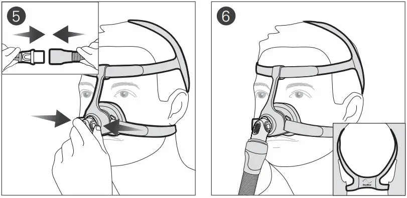 ResMed-N20-Airfit-Nasal-Mask-3