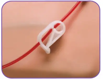 BD Nexiva Closed IV Catheter System - Clamp & Replace