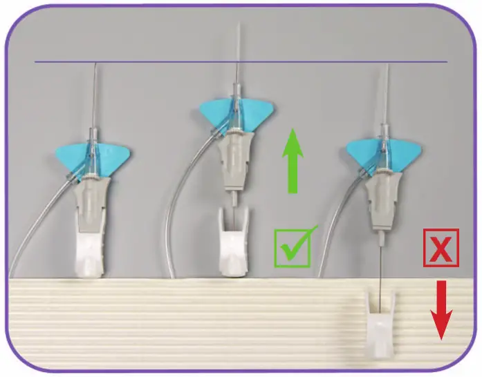 BD Nexiva Closed IV Catheter System - Forward First 1