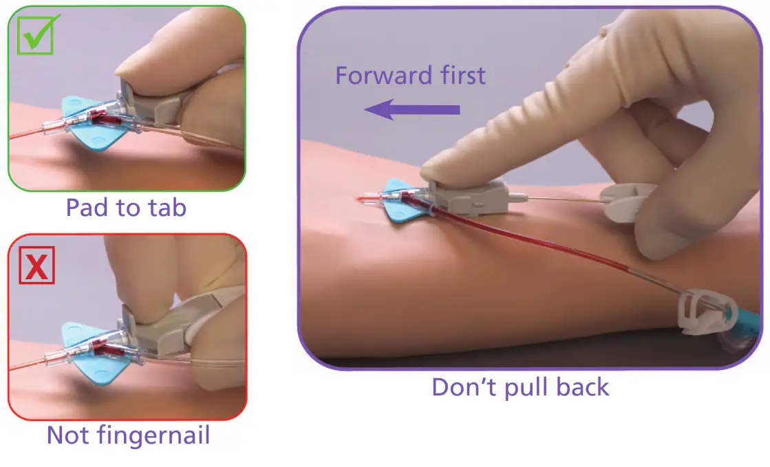 BD Nexiva Closed IV Catheter System - Forward First