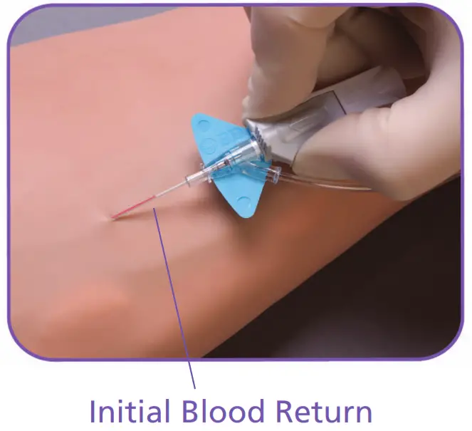 BD Nexiva Closed IV Catheter System - Needle Technology