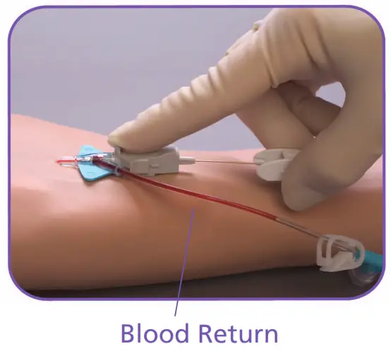 BD Nexiva Closed IV Catheter System - Secondary Flash