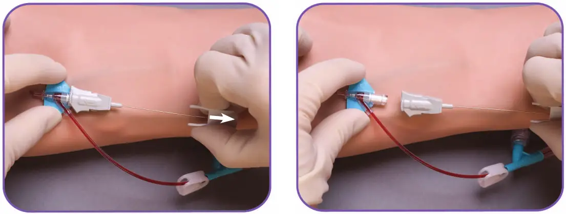 BD Nexiva Closed IV Catheter System - Stabilize & Remove