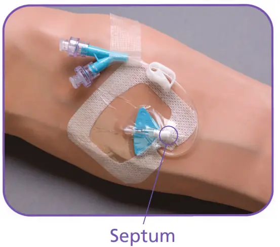 BD Nexiva Closed IV Catheter System - Stabilize Site
