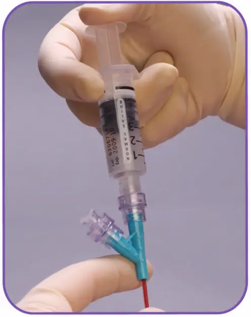 BD Nexiva Closed IV Catheter System - Unclamp & Flush