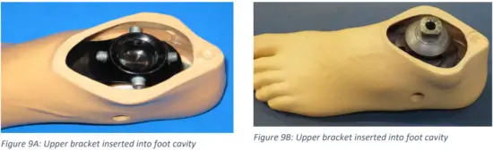 Trulife SKF100 Kinetic Foot Ankle and Pylon System for K2 Level - Fig 10