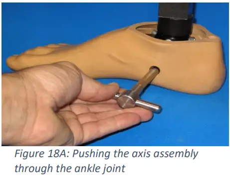 Trulife SKF100 Kinetic Foot Ankle and Pylon System for K2 Level - Fig 12