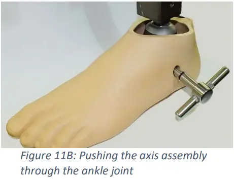 Trulife SKF100 Kinetic Foot Ankle and Pylon System for K2 Level - Fig 13