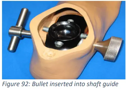 Trulife SKF100 Kinetic Foot Ankle and Pylon System for K2 Level - Fig 14