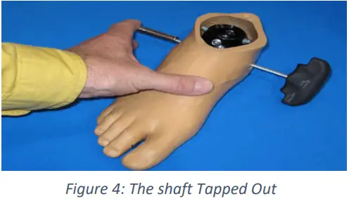 Trulife SKF100 Kinetic Foot Ankle and Pylon System for K2 Level - Fig 4