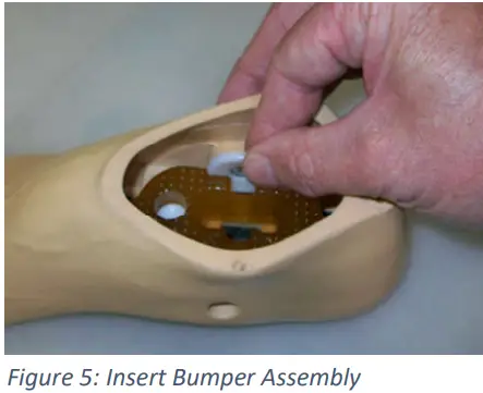 Trulife SKF100 Kinetic Foot Ankle and Pylon System for K2 Level - Fig 7