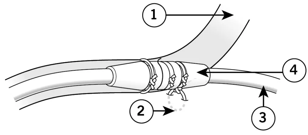 ST JUDE MEDICAL 1944 IsoFlex J Shape Pacing Lead - Anchoring