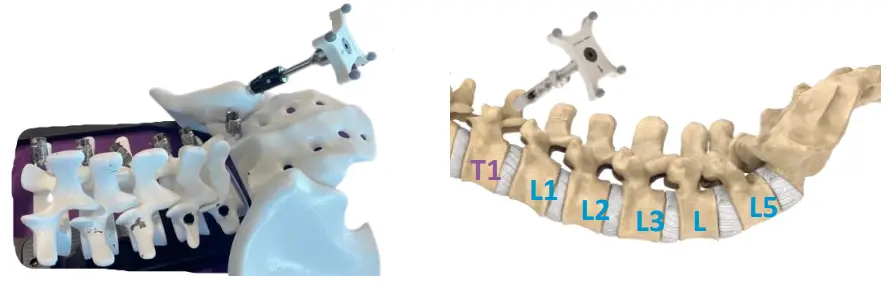 NUVASIVE-5050310-Pulse-Cios-Navigation-fig-10